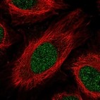 Immunofluorescent staining of human cell line HeLa shows localization to nucleoplasm.