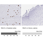 Anti-RALYL Antibody