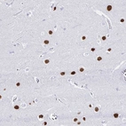 Immunohistochemical staining of human cerebral cortex shows strong nuclear positivity in neuronal cells.