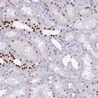 Anti-RALYL Antibody