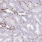 Immunohistochemical staining of human kidney shows strong nuclear positivity in cells in tubules.
