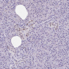 Anti-RALYL Antibody