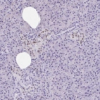 Immunohistochemical staining of human pancreas shows moderate nuclear positivity in islets of Langerhans.