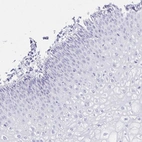 Immunohistochemical staining of human cervix, uterine shows negative nuclear positivity in squamous epithelial cells as expected.