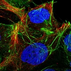 Immunofluorescent staining of human cell line CACO-2 shows positivity in nucleoli, plasma membrane, actin filaments & cell junctions.