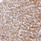 Anti-APOC2 Antibody