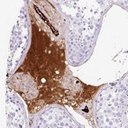 Immunohistochemical staining of human testis shows strong positivity in plasma.