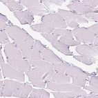 Immunohistochemical staining of human skeletal muscle shows no positivity in myocytes as expected.