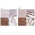 Anti-RPS5 Antibody