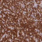 Anti-RPS5 Antibody