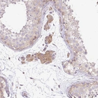 Immunohistochemical staining of human testis shows moderate cytoplasmic-nucleoli positivity in Leydig cells.
