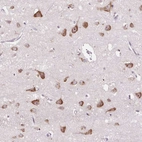 Immunohistochemical staining of human cerebral cortex shows strong cytoplasmic-nucleoli positivity in neurons.