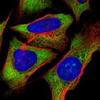 Immunofluorescent staining of human cell line U-2 OS shows localization to cytosol & endoplasmic reticulum.