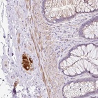 Anti-CCL25 Antibody