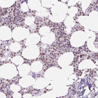 Anti-VPREB1 Antibody