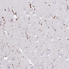 Anti-FAM107A Antibody