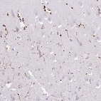 Immunohistochemical staining of human hippocampus shows moderate to strong nuclear positivity in glial cells.