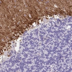Immunohistochemical staining of human cerebellum shows moderate to strong positivity.