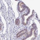 Immunohistochemical staining of human fallopian tube shows nuclear positivity in glandular cells.