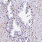 Anti-FAM107A Antibody