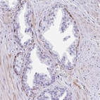 Immunohistochemical staining of human prostate shows moderate nuclear positivity.