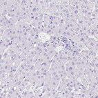 Anti-FAM107A Antibody