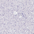Immunohistochemical staining of human liver shows no nuclear positivity in hepatocytes as expected.