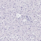 Immunohistochemical staining of human liver shows no nuclear positivity in hepatocytes as expected.
