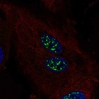 Immunofluorescent staining of human cell line HUVEC TERT2 shows localization to nuclear speckles.