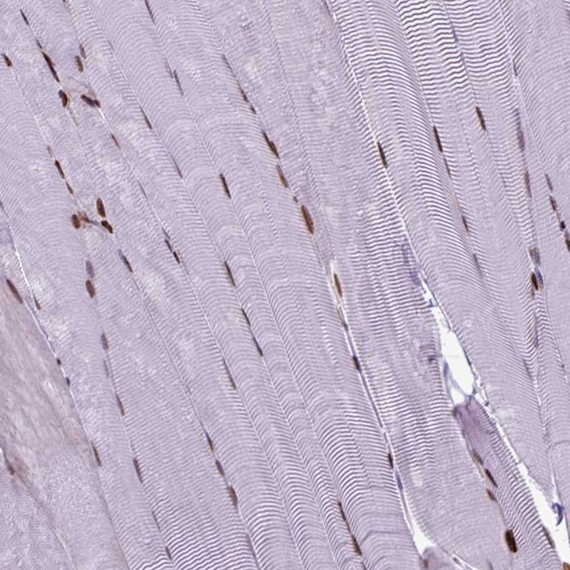 Anti-HIST1H1C Antibody