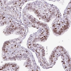 Immunohistochemical staining of human fallopian tube shows moderate nuclear positivity in glandular cells.