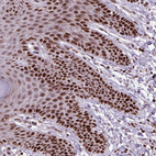 Immunohistochemical staining of human skin shows strong nuclear positivity in squamous epithelial cells.