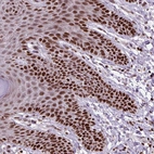 Immunohistochemical staining of human skin shows strong nuclear positivity in squamous epithelial cells.