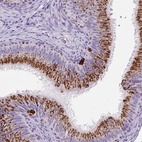 Anti-LCN10 Antibody