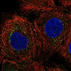 Immunofluorescent staining of human cell line MCF7 shows localization to vesicles.