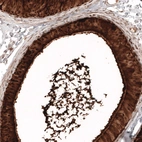 Immunohistochemical staining of human epididymis shows strong cytoplasmic positivity in glandular cells.