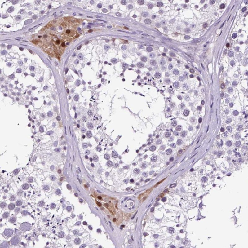 Anti-FAM19A3 Antibody