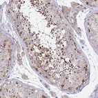 Immunohistochemical staining of human testis shows moderate to strong granular cytoplasmic positivity in cells in seminiferous ducts.