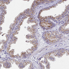Immunohistochemical staining of human prostate shows moderate to strong granular cytoplasmic positivity in glandular cells.