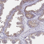 Immunohistochemical staining of human prostate shows moderate to strong granular cytoplasmic positivity in glandular cells.