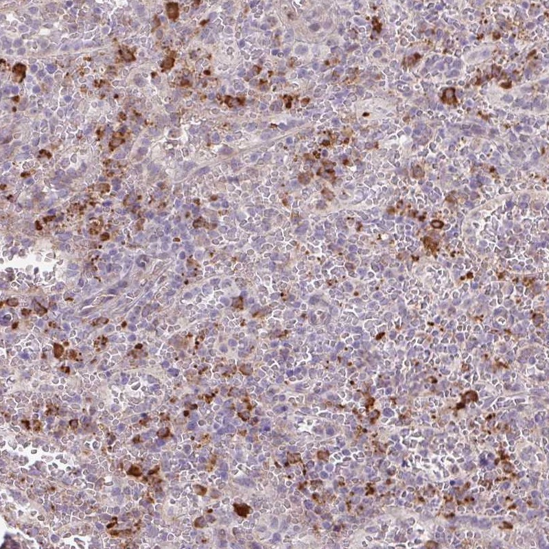 Anti-TAF1D Antibody