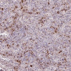 Anti-TAF1D Antibody