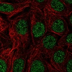 Immunofluorescent staining of human cell line MCF7 shows localization to nucleoplasm.
