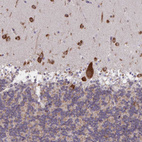 Immunohistochemical staining of human cerebellum shows strong granular cytoplasmic positivity in Purkinje cells and cells in molecular layer.
