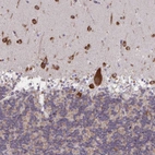 Immunohistochemical staining of human cerebellum shows strong granular cytoplasmic positivity in Purkinje cells and cells in molecular layer.