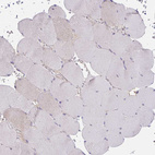 Immunohistochemical staining of human skeletal muscle shows no positivity in myocytes as expected.