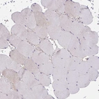 Immunohistochemical staining of human skeletal muscle shows no positivity in myocytes as expected.