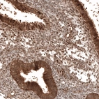 Immunohistochemical staining of human endometrium shows strong cytoplasmic positivity in glandular cells.