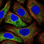 Immunofluorescent staining of human cell line A549 shows localization to vesicles.