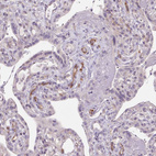 Immunohistochemical staining of human placenta shows moderate membranous positivity in endothelial cells.